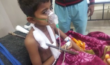 इस बच्चे को जिसने भी देखा एक पल के लिए सहम सा गया