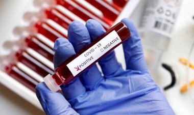 मध्यप्रदेश: कोरोना संक्रमित हुए उच्च शिक्षा विभाग में पदस्थ ओएसडी, विभाग में हड़कंप ....