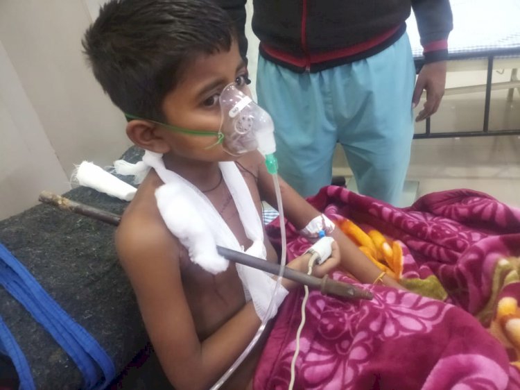 इस बच्चे को जिसने भी देखा एक पल के लिए सहम सा गया